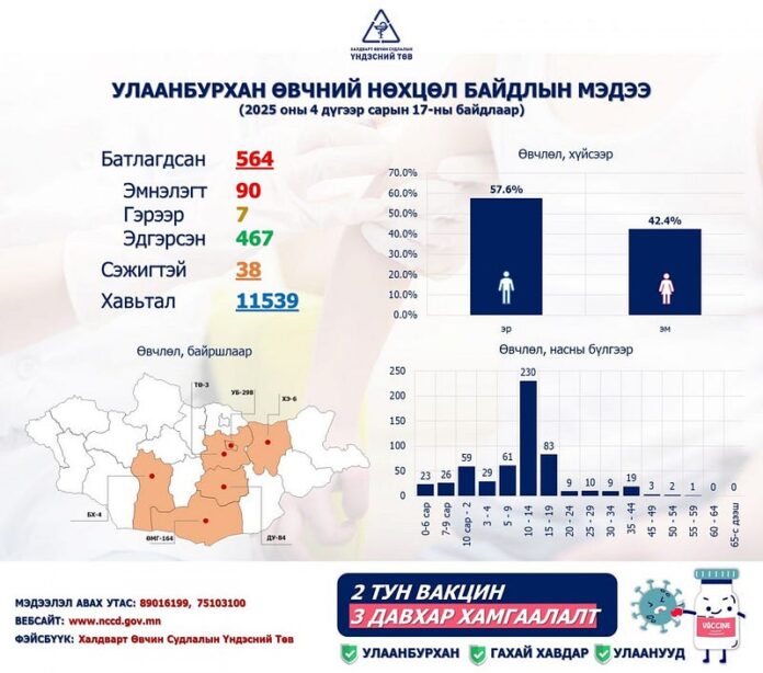 Улаанбурхан өвчний батлагдсан тохиолдлын хавьтал 11539 байна