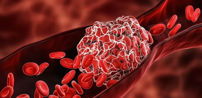 Судсыг гэмтээдэг хоол хүнс: Хүн бүрийн хэтрүүлэн хэрэглэдэг зүйлс
